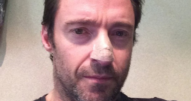 Hugh Jackman en la foto que publicó en Instagram