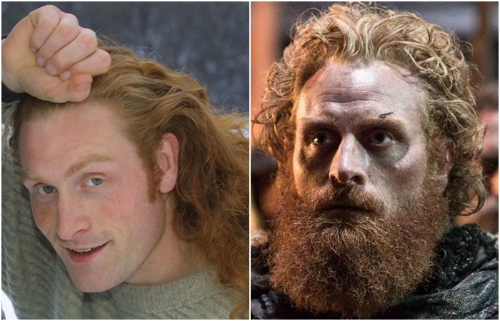 Kristofer Hivju Tormund