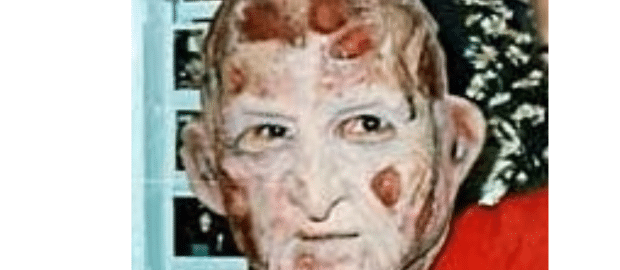 Las caras de Freddy Krueger