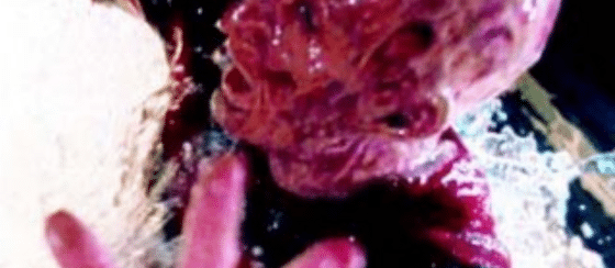 Las caras de Freddy Krueger